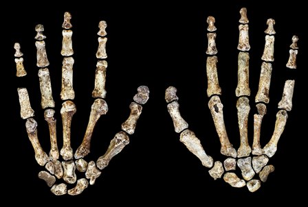 Fossil hand showing palmar and dorsal views